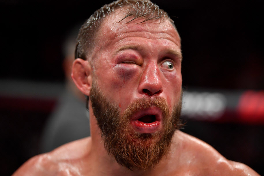 Cộng đồng mạng nói gì khi Donald Cerrone vs. Tony Ferguson phải kết thúc theo yêu cầu bác sĩ? Cộng đồng mạng nói gì khi Donald Cerrone vs. Tony Ferguson phải kết thúc theo yêu cầu bác sĩ?